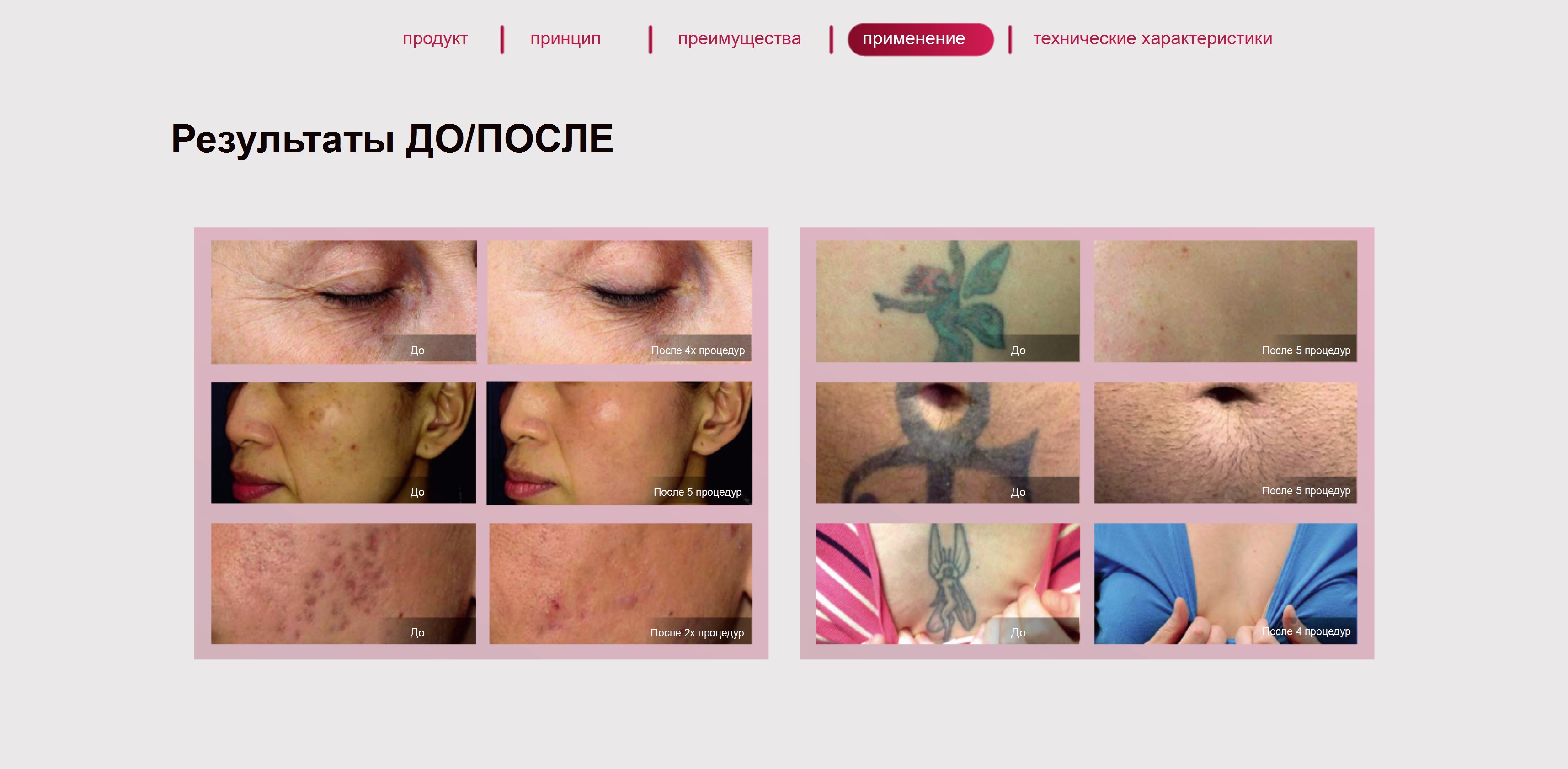Фотографии результатов до и после процедур